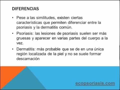 Eczema di disgidrotichesky suprastin Che guarire leczema sulle dita