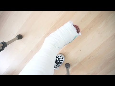 Lil Slump Broke My Foot While Skating