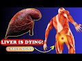 LIVER is DYING! 12 Weird Signs of LIVER DAMAGE | Health care