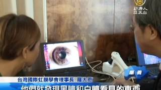 【健康醫療 台灣新聞】醫學新技崛起  虹膜分析查體質