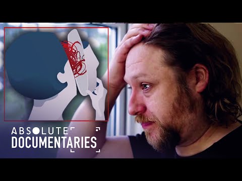 Living With Pure O (OCD And Mental Health Documentary) | Absolute Documentaries