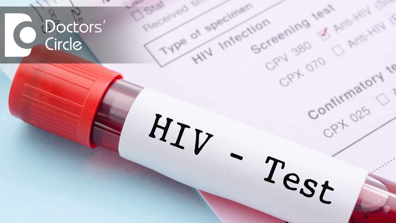 Is HIV -ve status confirmed after non reactive values on 63,86 & 126 days - Dr. Ramakrishna Prasad