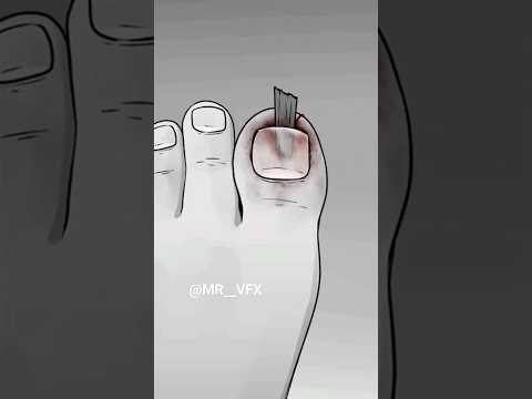 Marvel Animation 156% Incredible Hulk 1    #shorts