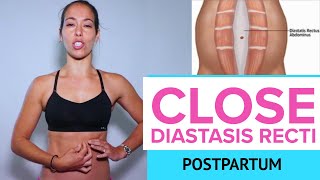 Heal Diastasis Recti with one Exercise | Close the Gap in 10 minutes per day | Fix Mommy Tummy