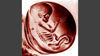 Embryodead