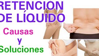 RETENCIÓN DE LÍQUIDOS. Causas y remedios.