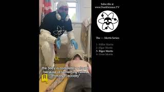 Stages of Death: Pallor, Algor, Rigor, Livor