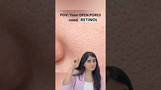 Open Pores | Open pores serum | Cream for open pores | Retinol for open pores