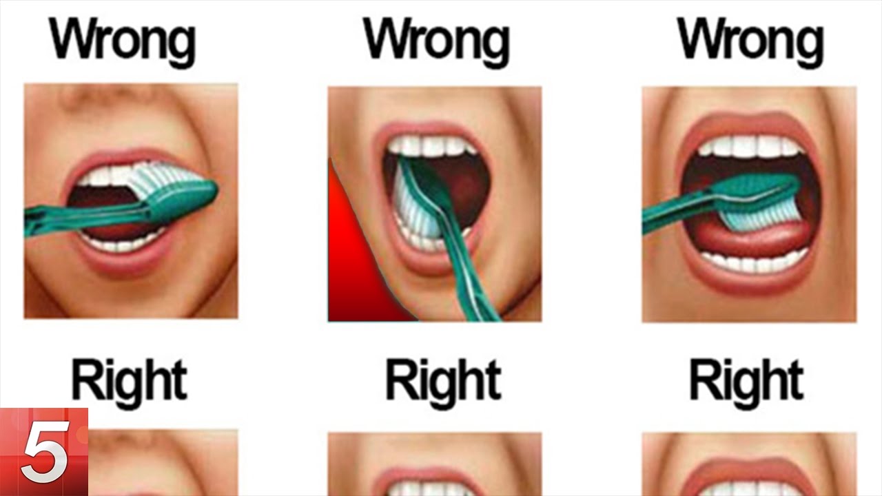hwo to uncrook teeth hwo to uncrook teeth