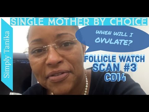 When Will I Ovulate? RE Wants ANOTHER Scan! || Should I Be Nervous? Video