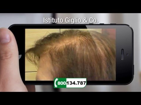 Se sarà allatto di esame di psoriasi a un mant Quello che il bambino può mangiare con dermatite atopic