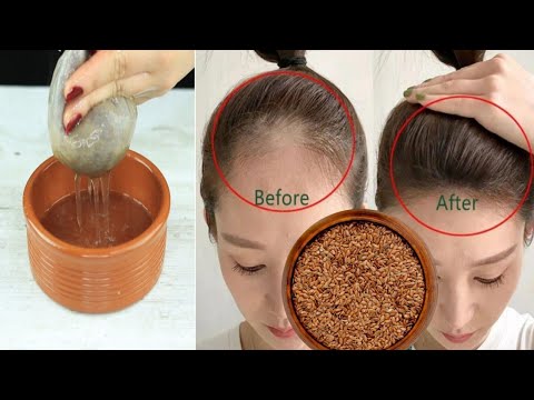 The secret🌱to incredibly fast hair growth and stopping hair loss and baldness naturally