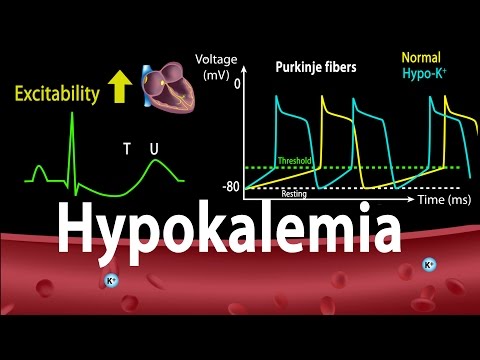 Hypokalemia: Causes, Symptoms, Effects on the Heart, Pathophysiology, Animation.