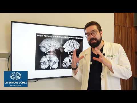 What is brain atrophy?