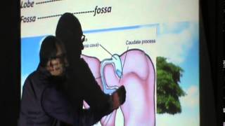 19 Dr Sherif Zaki 17 3 2015 Liver 1