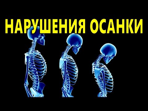 Компьютерные столы трансформеры осанка купить Что испытывают при сколиозе