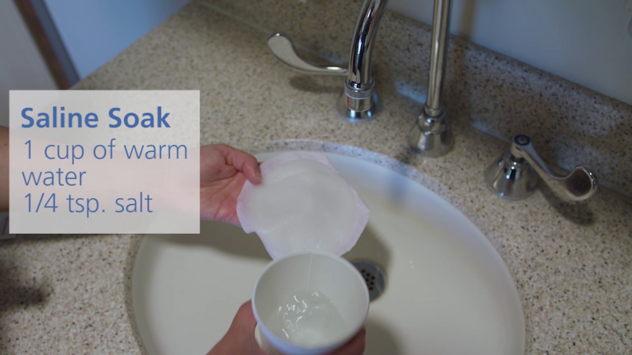 What can you do for sore breasts while breastfeeding? Tipseri