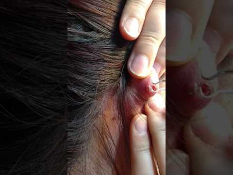 Piercing pop