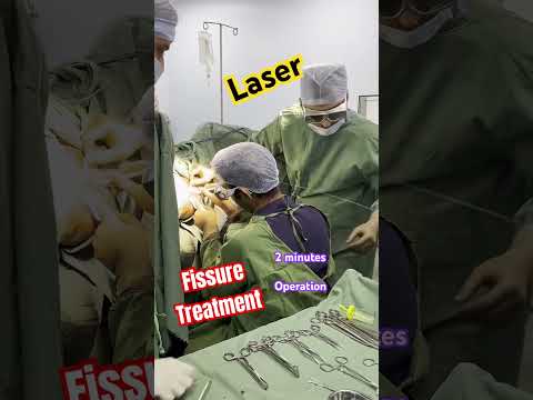 2 minutes mein Laser FISSURE Surgery I Fissure in ano Treatment I Operation kaise hota hai I PILES