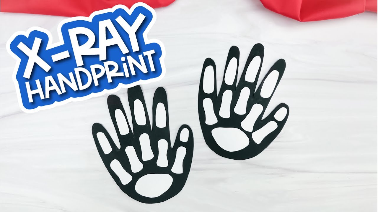 X Ray Handprint Craft For Kids