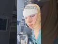 Having 5 Facial Feminization SURGERIES At ONCE