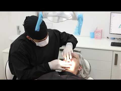 Root Canal and Dental Implants Success Story in Mexico-Testimonial