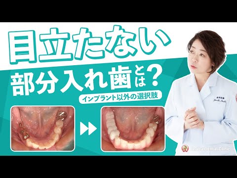 目立たない部分入れ歯とは？〜インプラント以外の選択肢〜