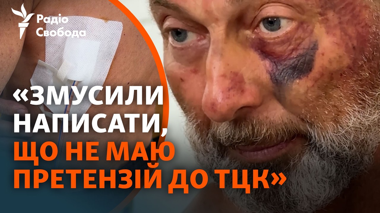 ТЦК побили пенсіонера, чоловік у лікарні: що сталося на Рівненщині