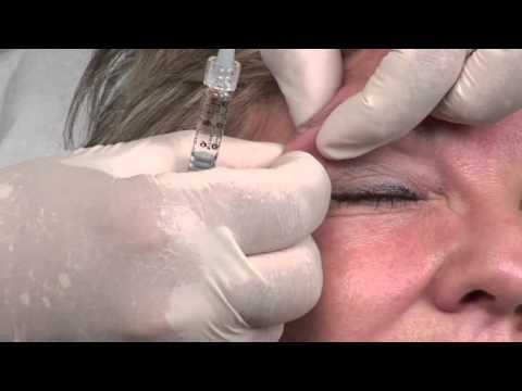 Laser epilation persona completamente La chiarificazione di pacco di faccia il dr. di 119 ampolla rischiarante maschera il foglio
