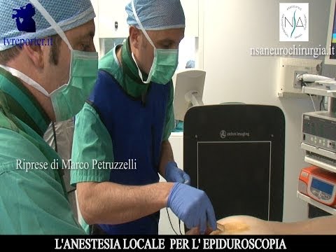 Sfregamento di mal di schiena Loperazione è effettuata ad unernie intervertebrali