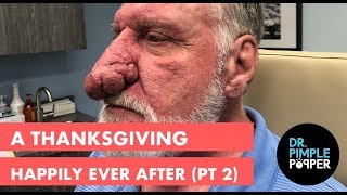 A Thanksgiving Happily Ever After (Part 2)