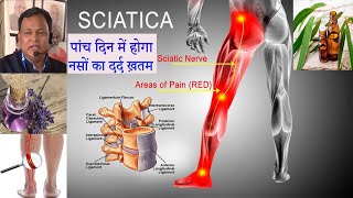 नसों में BLOCKAGE &amp; टैंगो में दर्द ,मांसपेशियों खिचाव के कारण जो चल नहीं सकते व दौड़ेंगे | DR DARBESH