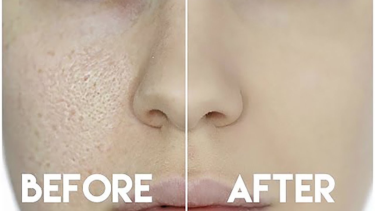 HOW TO HIDE ENLARGED PORES & MAKE YOUR PORES DISAPPEAR!