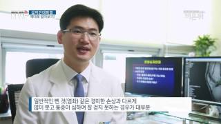 십자인대파열의 치료법