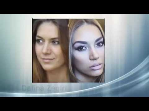 Ndryshimi i vipave para dhe pas operacioneve plastike