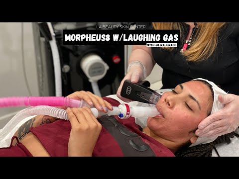 MORPHEUS8 W/laughing gas