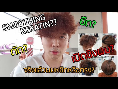 Kanoplya ในโรคสะเก็ดเงิน อาการของอาการโรคสะเก็ดเงิน