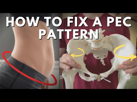 How to Fix a PEC Pattern + Relationships to the PRI Left AIC