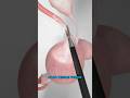 Electric Birth Control 3D Animation