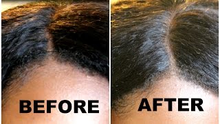 Quick Fix for a Lifting Closure! - No glue, no tape, no sew