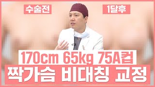 AB TV - 성형 수술 케이스 리뷰 후기