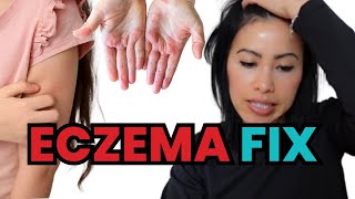 How to treat kids' eczema without medications. Home solutions for mom to use.