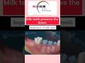 Why are Milk teeth Important? #babyteeth #baby #teeth #kidsdentist