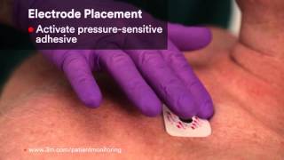 Product video: 3M Red Dot Electrodes for Patient Monitoring