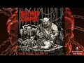 SKINNED CORPSE Braindead Bastards 𝐓𝐑𝐀𝐂𝐊 𝐏𝐑𝐄𝐌𝐈𝐄𝐑𝐄 𝟐𝟎𝟐