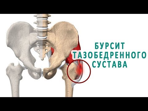 Боли в суставах при береме Может ли от шейного остеохондроза болеть левая рука
