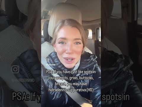 Could you have hidradenitis suppurativa (HS)? #dermatologist #hs #dermatology