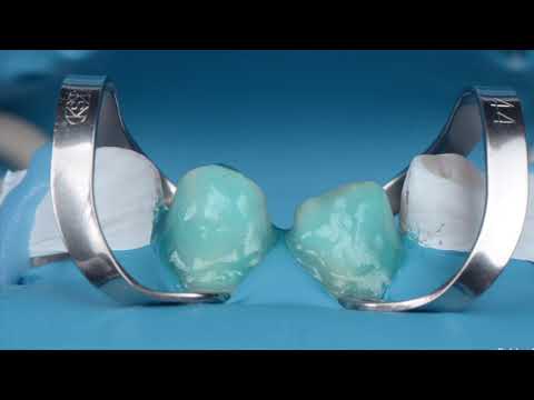 Препарирование зубов, адгезивная фиксация