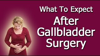 What To Expect After Gallbladder Surgery
