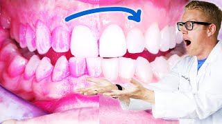 Dentist Reveals the Best ORAL HYGIENE ROUTINE for DENTAL CARE: Properly Brush, Floss, & Clean Teeth!
